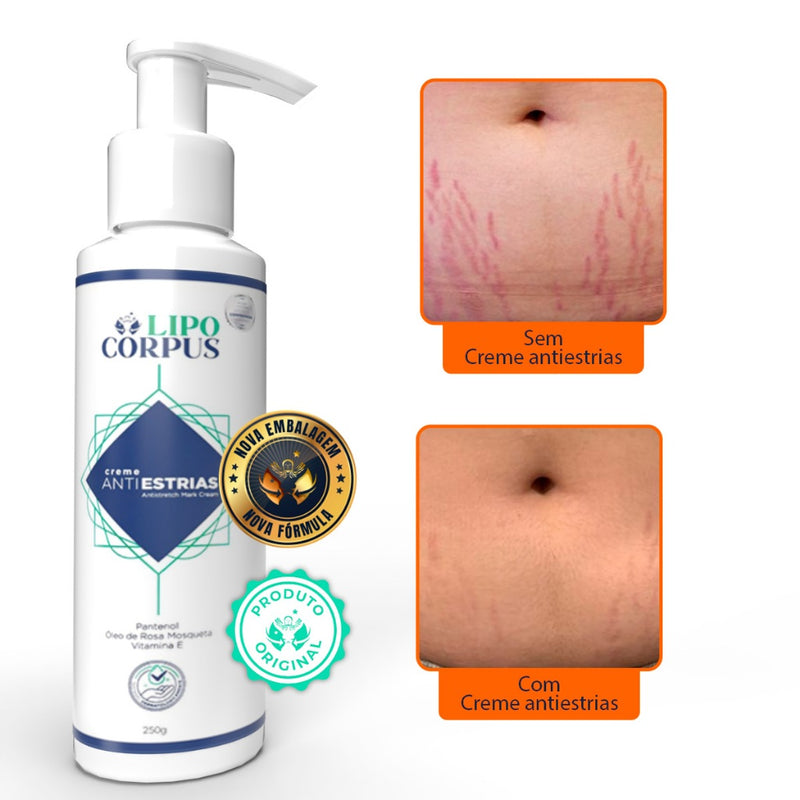 Creme AntiEstrias Removedor Estrias 250g Lipo Corpus